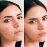 Creme facial hidratante, pele oleosa e acne, com CBD, ecológico - Herbera Biocosmética